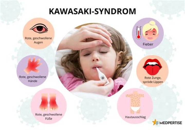 Which medication is usually given to children diagnosed with Kawasaki disease?