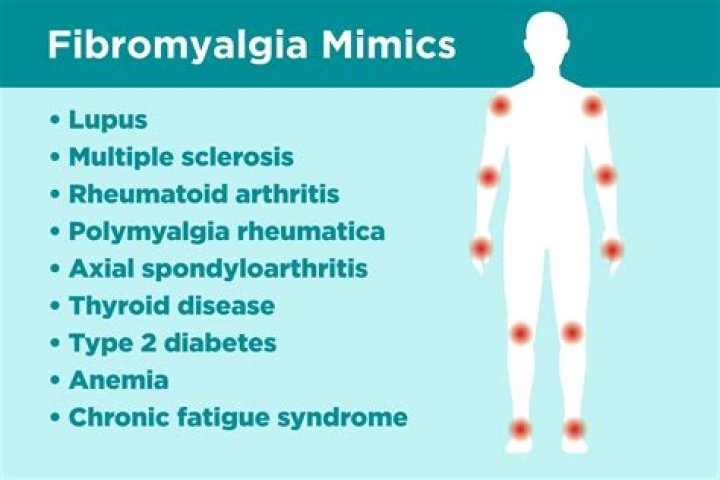 Who can diagnose fibromyalgia?