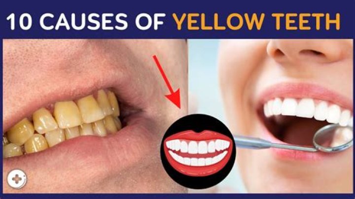Why do teeth look yellow in sunlight?