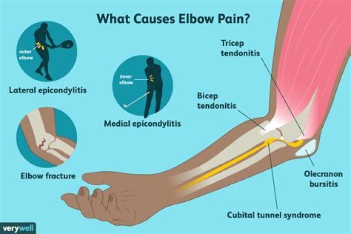 Why does my elbow hurt so bad?