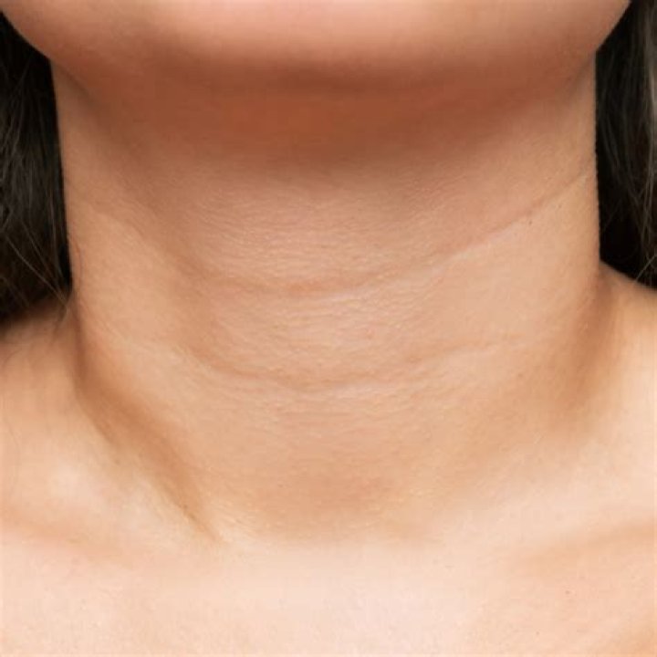 Why does my neck look wrinkled?