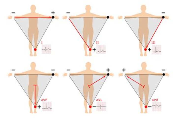 Why is lead II used in ECG?