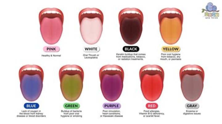 Why is my tongue blue green?